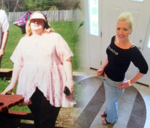 Before and After 4